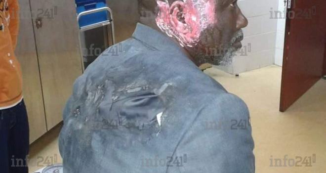 Une victime de la répression policière gabonaise autour du retour de Jean Ping à Libreville 