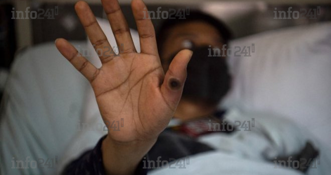 Variole du singe en Afrique : Plus de 31 000 cas recensés et 844 décès depuis janvier