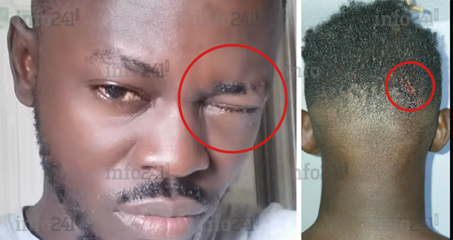 Bavures policières au Gabon&nbsp;: le rappeur Garçin Lagaçant témoigne en musique