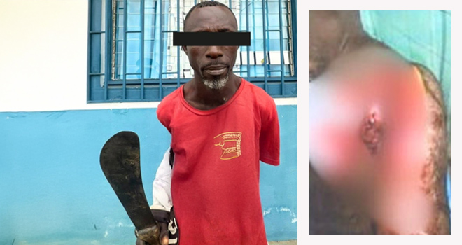 Nkoltang&nbsp;: Un ghanéen cocufié tente de trancher le cou de son rival gabonais à la machette