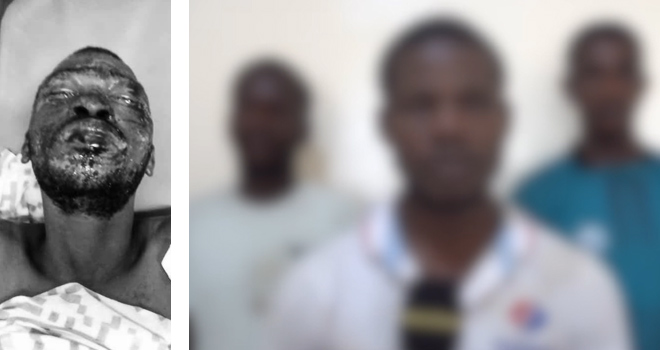 Port-Gentil&nbsp;: 3 &laquo;&nbsp;initiés&nbsp;&raquo; écroués après avoir brulé leur victime lors d’une cérémonie traditionnelle