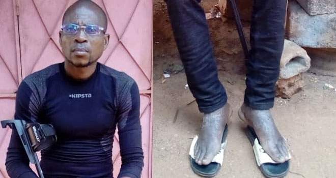 Lebamba&nbsp;: Déjà cocufié, un gabonais se voit paralyser des deux jambes par son rival nganga