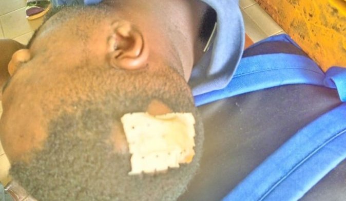 Oyem&nbsp;: Une rixe entre 3 jeunes gabonais pour de la bière volée finit à l’hôpital et à la DGR&nbsp;!